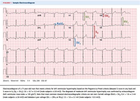 lvh medical abbreviation